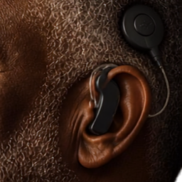 Cochlear Implant external sound processor